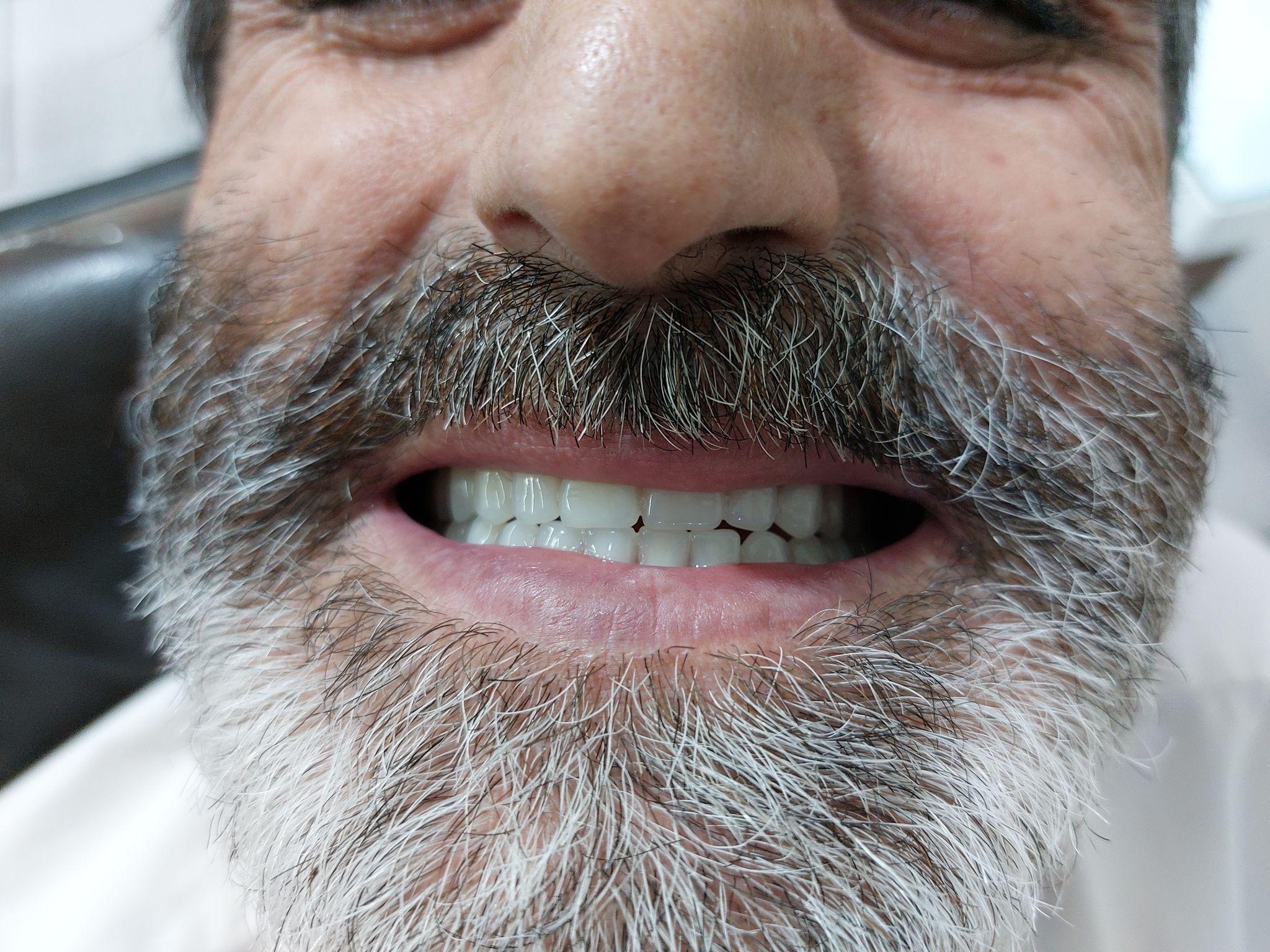 دندانسازی غفاری