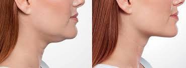 اهورا بیوتی