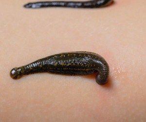 مرکز تخصصی زالو درمانی فاطمی