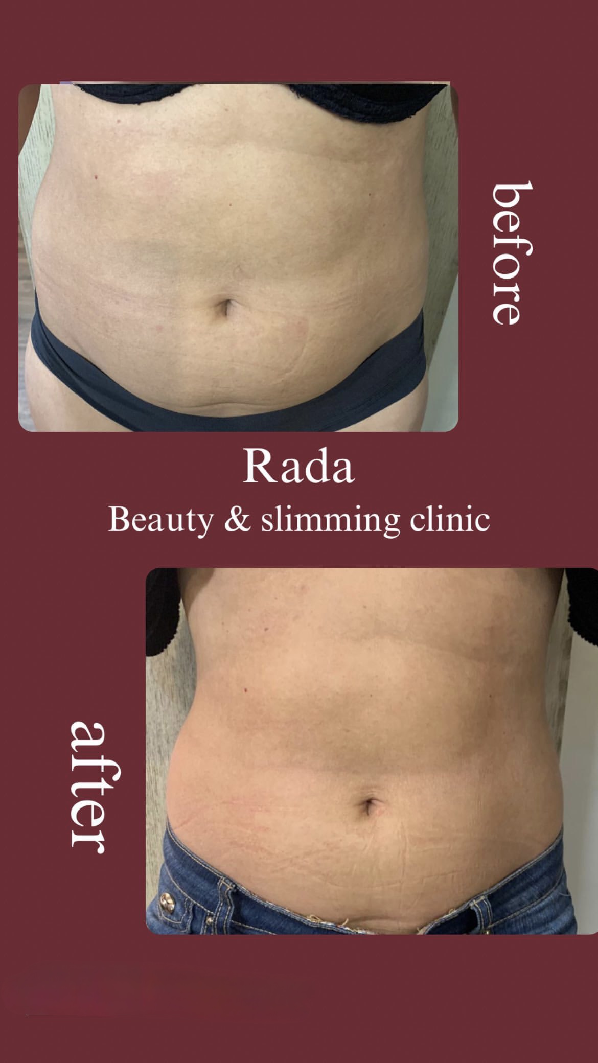 مرکز زیبایی رادا