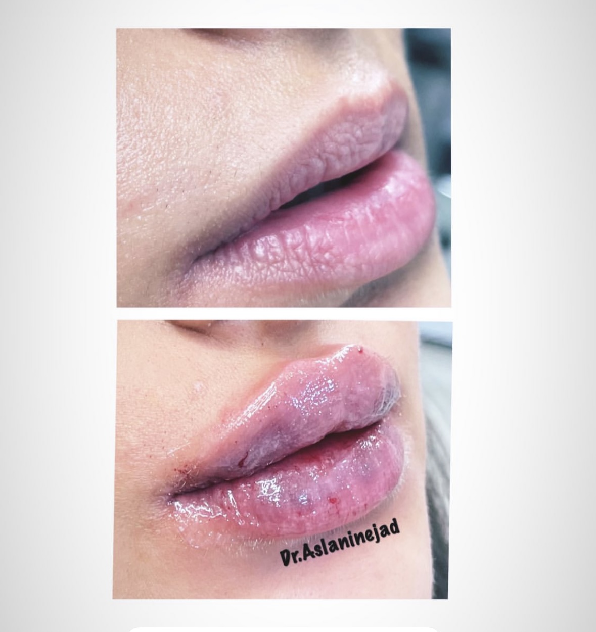 مطب پوست و زیبایی دکتر اصلانی نژاد