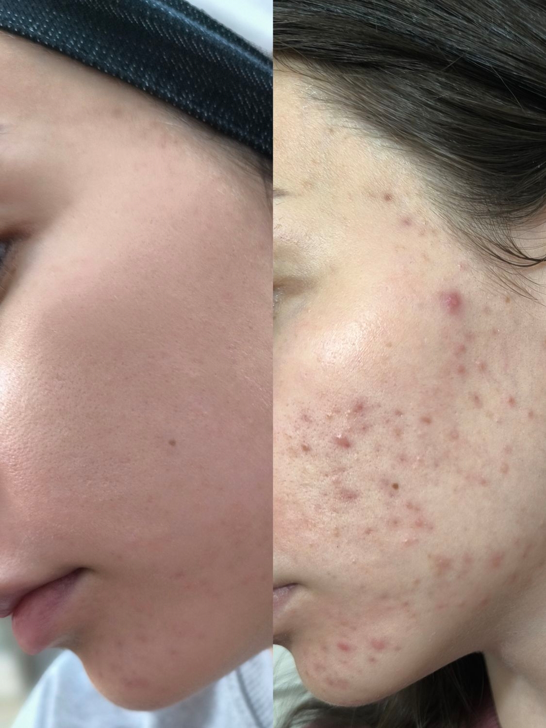 Derma Elan