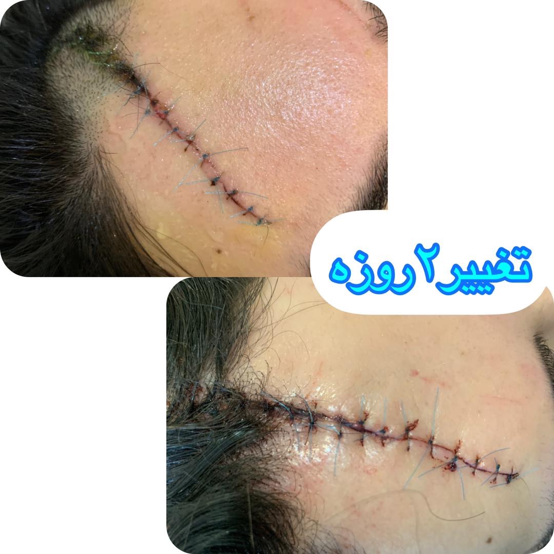 خدمات پرستاری نیک توان