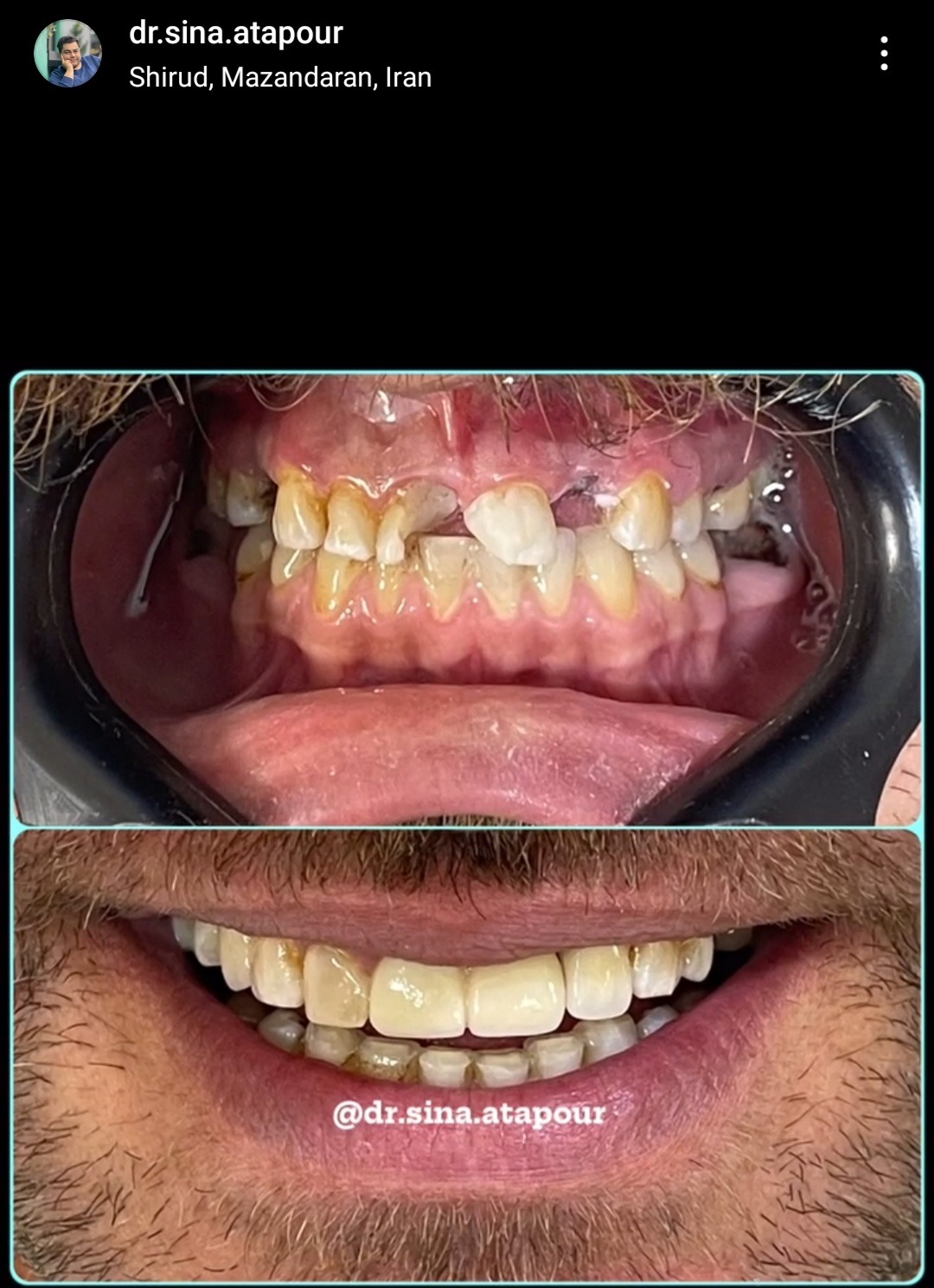 دندانپزشکی دکتر سینا عطاپور