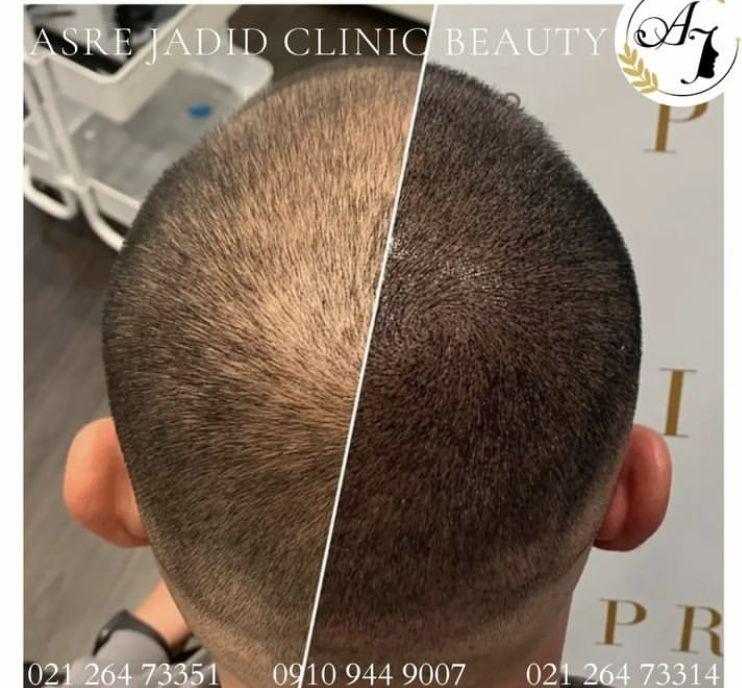 کلینیک پوست و مو  وزیبای ولیزر کندلا در عصر جدید