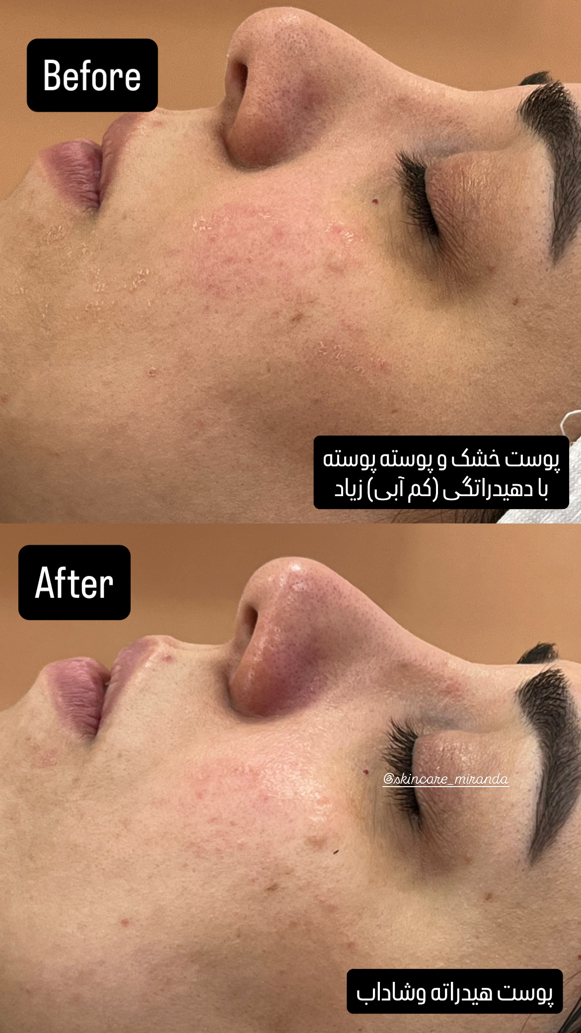 خدمات پوستی میراندا آواک
