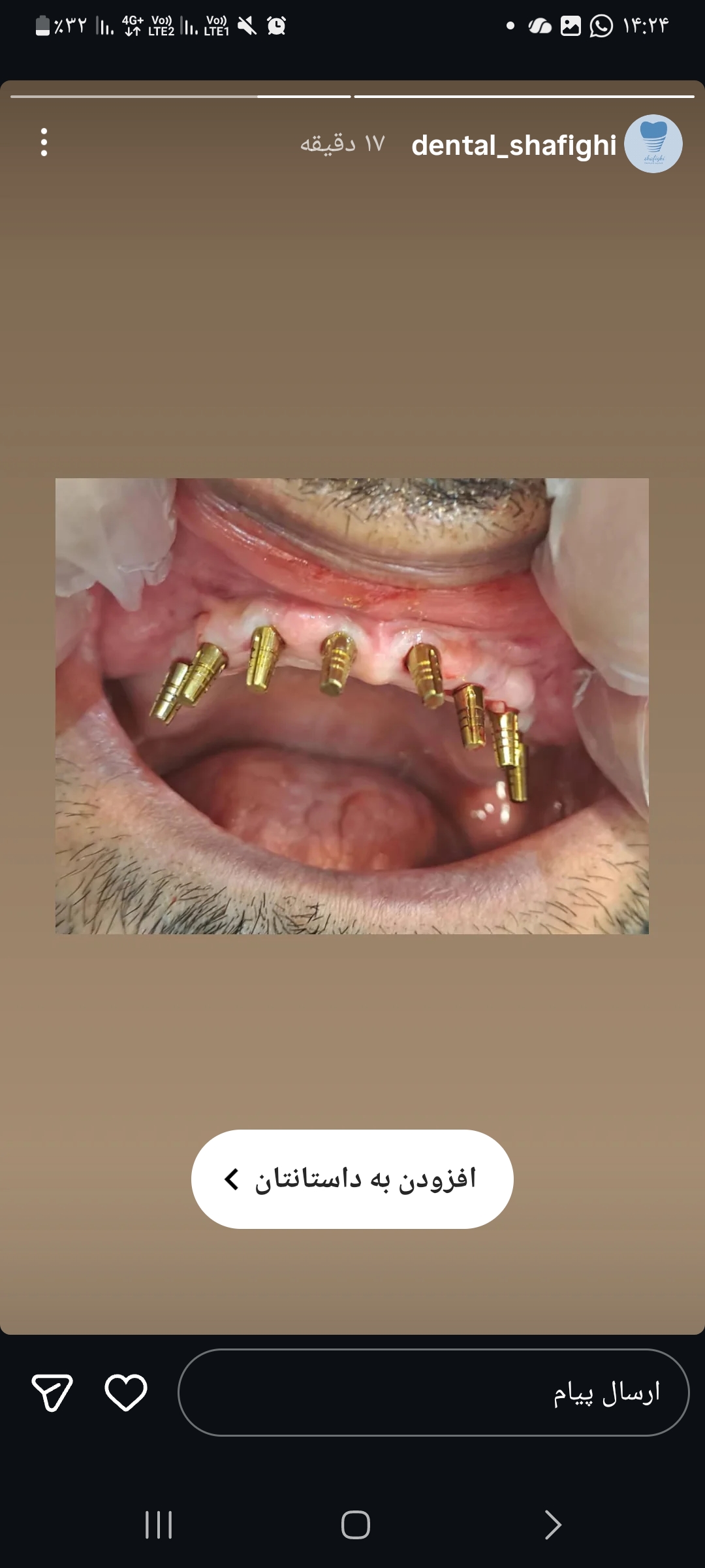 دندانپزشکی برز