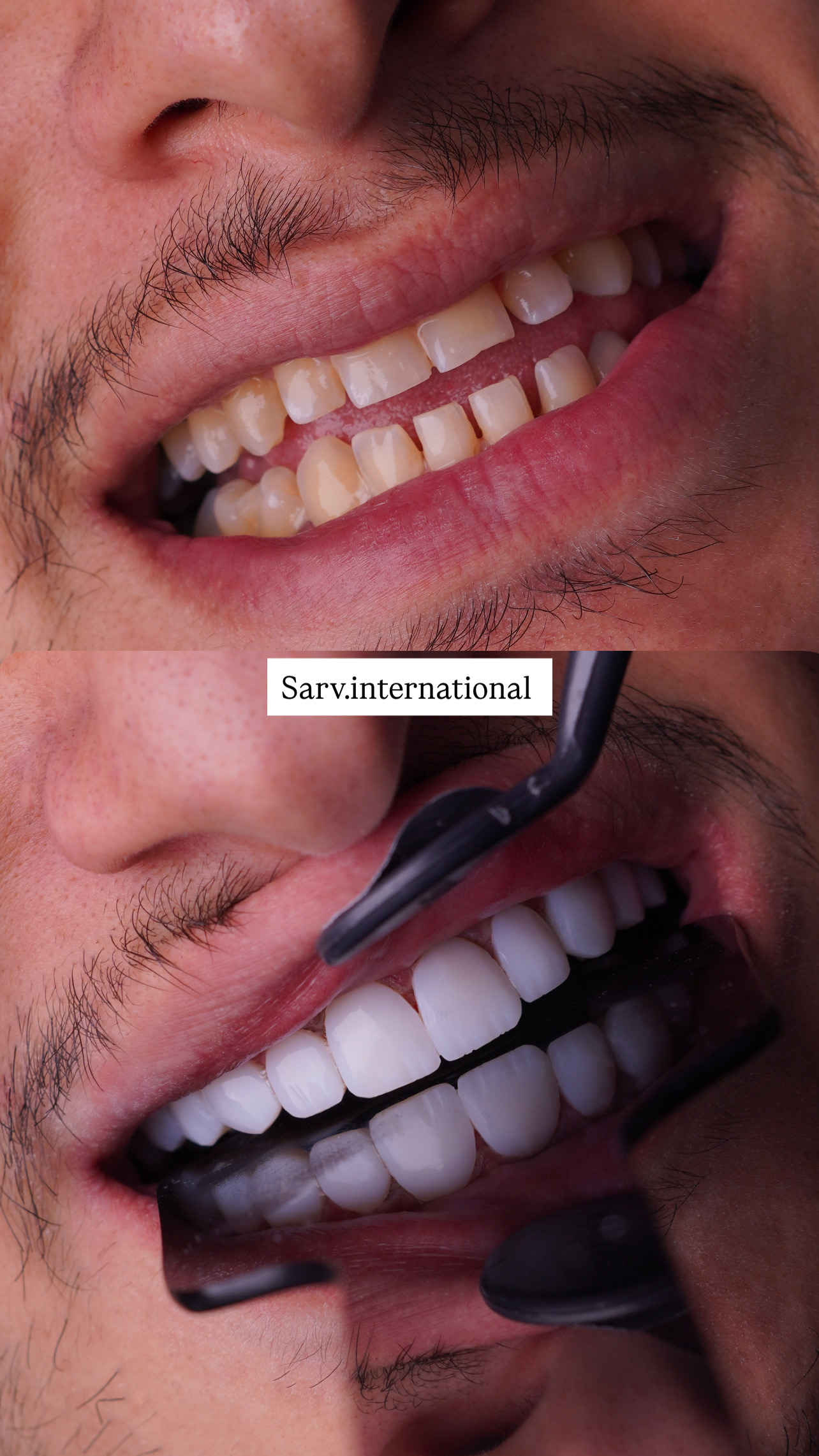 دکتر الهه بداقی، دکترای دندانپزشک