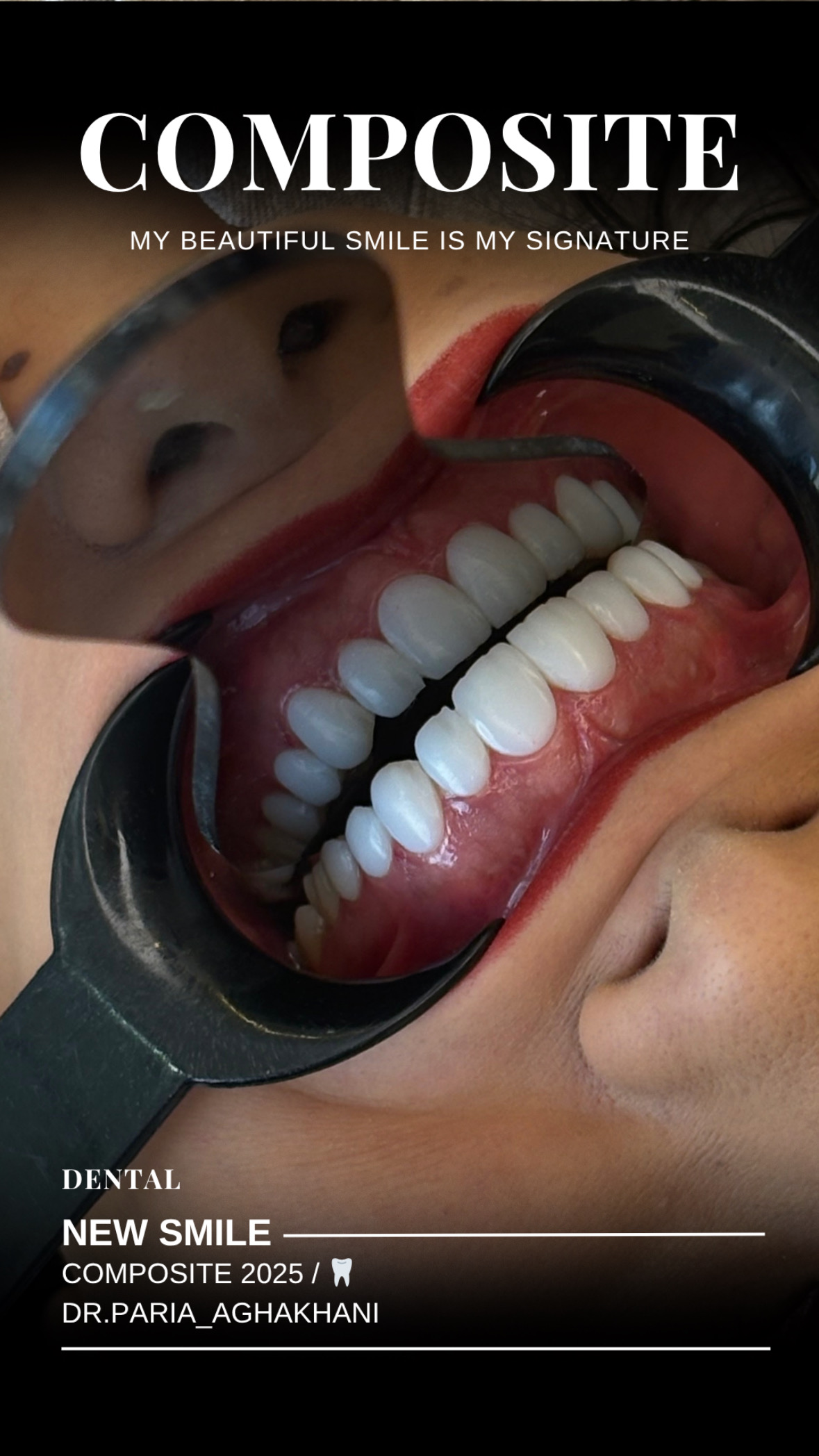 دندانپزشکی دکتر پریا آقاخانی(اقساط)