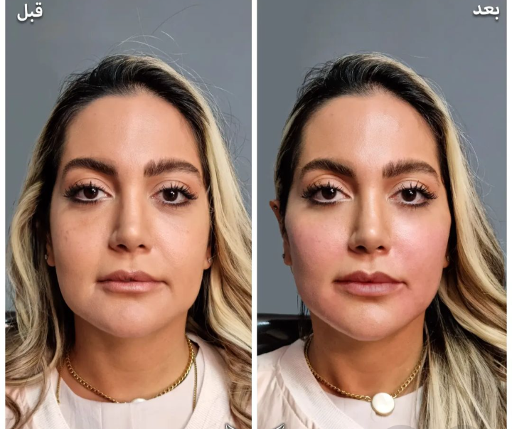 بیوتی تراپی