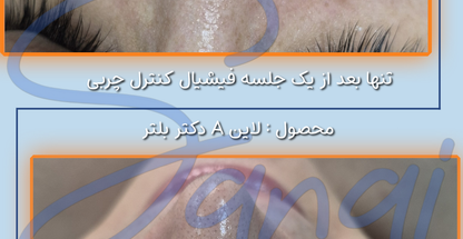 خانه ی پوست سانای