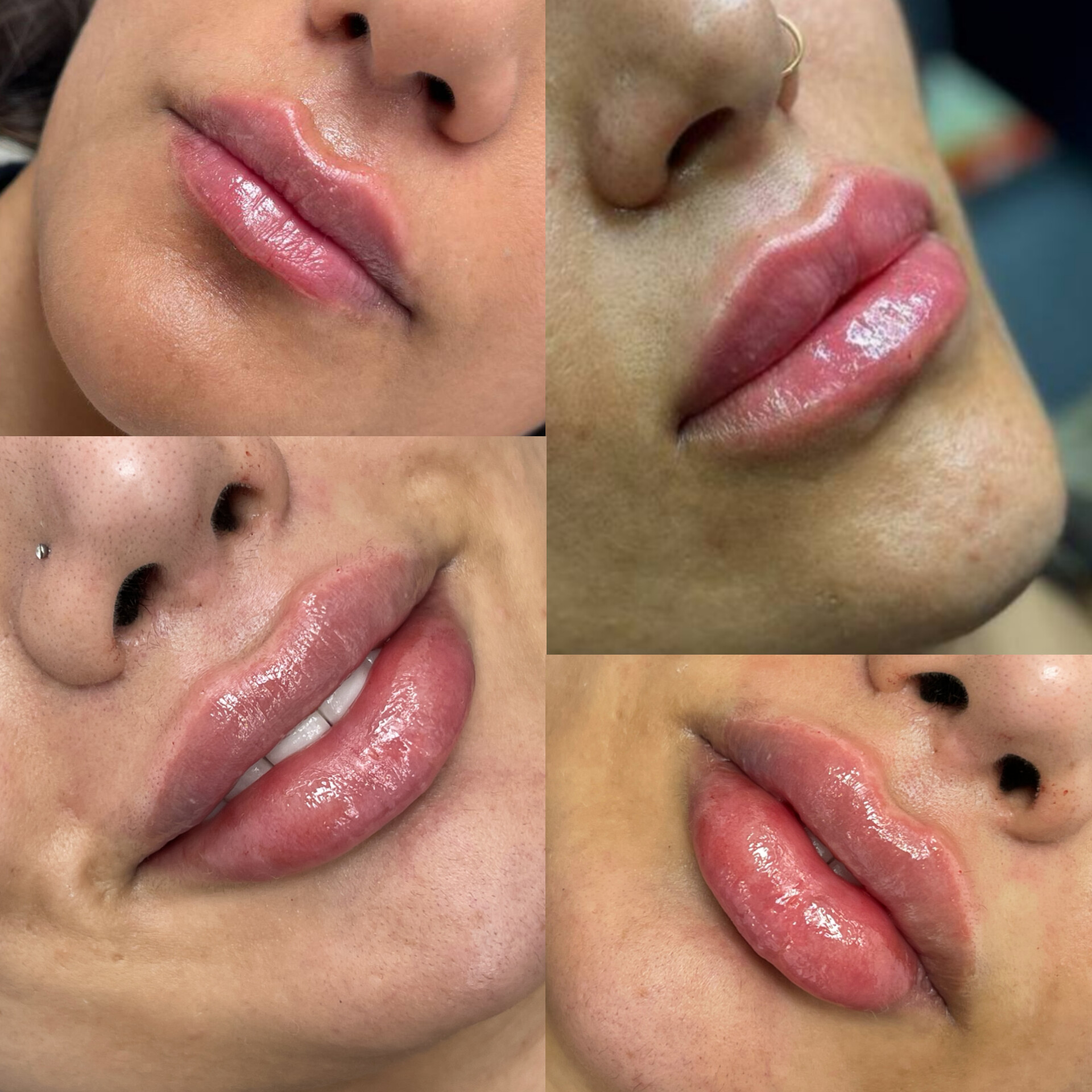 مطب زیبایی ولیزر مهرزاد کرج