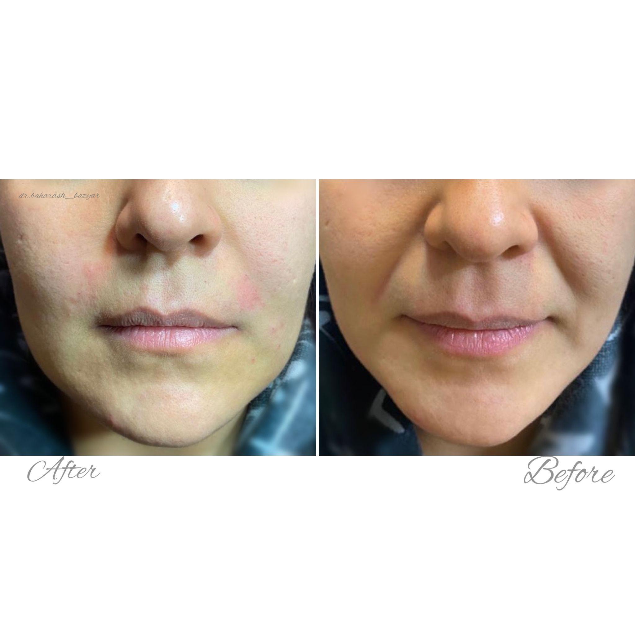 مرکز پوست مو زیبایی دکتر بهارش بازیار