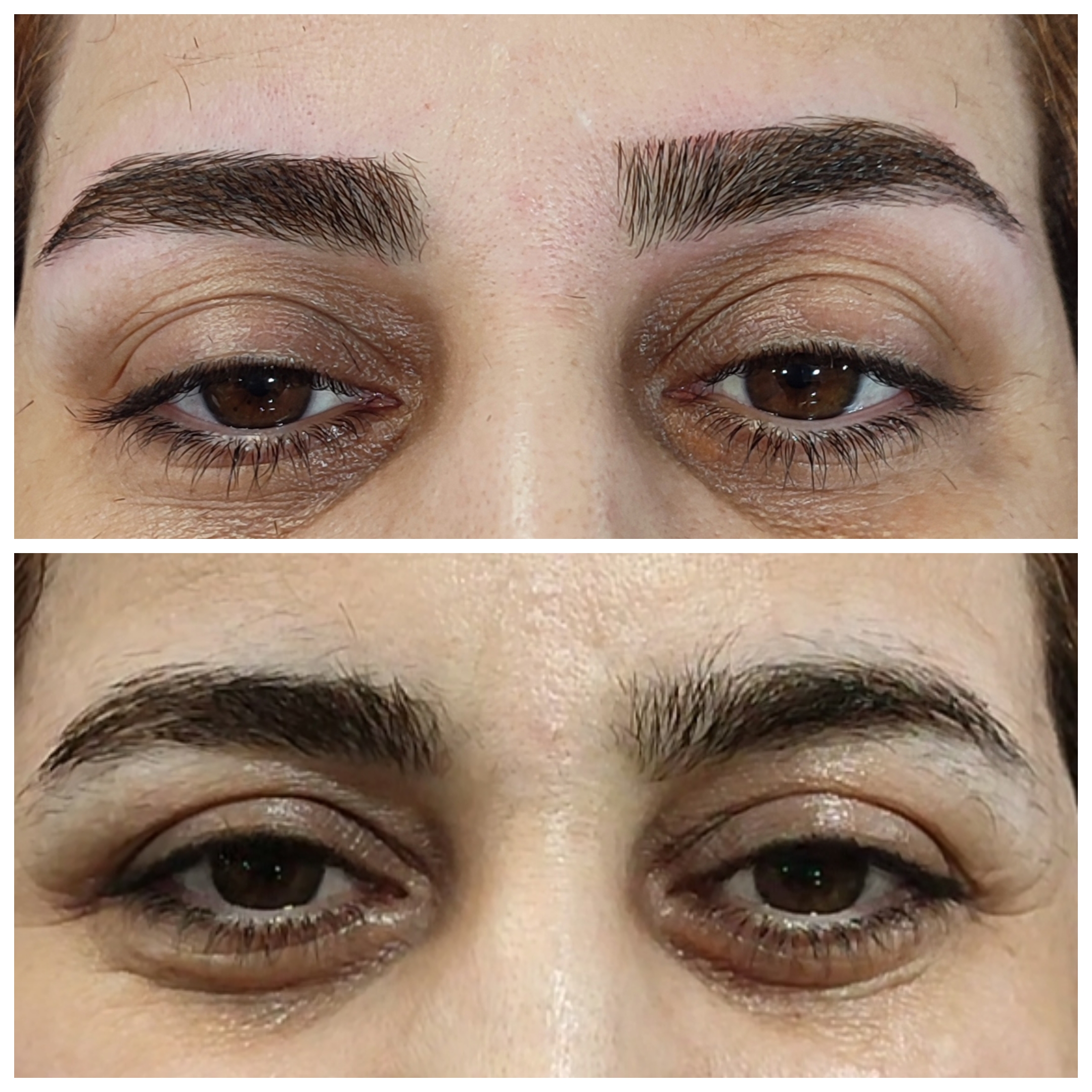 اصلاح تخصصی وترمیمی ابروی فرزانه