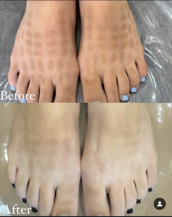 فیشال و پاکسازی پوست مرضیه صالحی