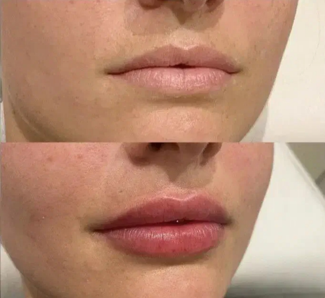 کلینیک پوست و زیبایی ری‌ماه