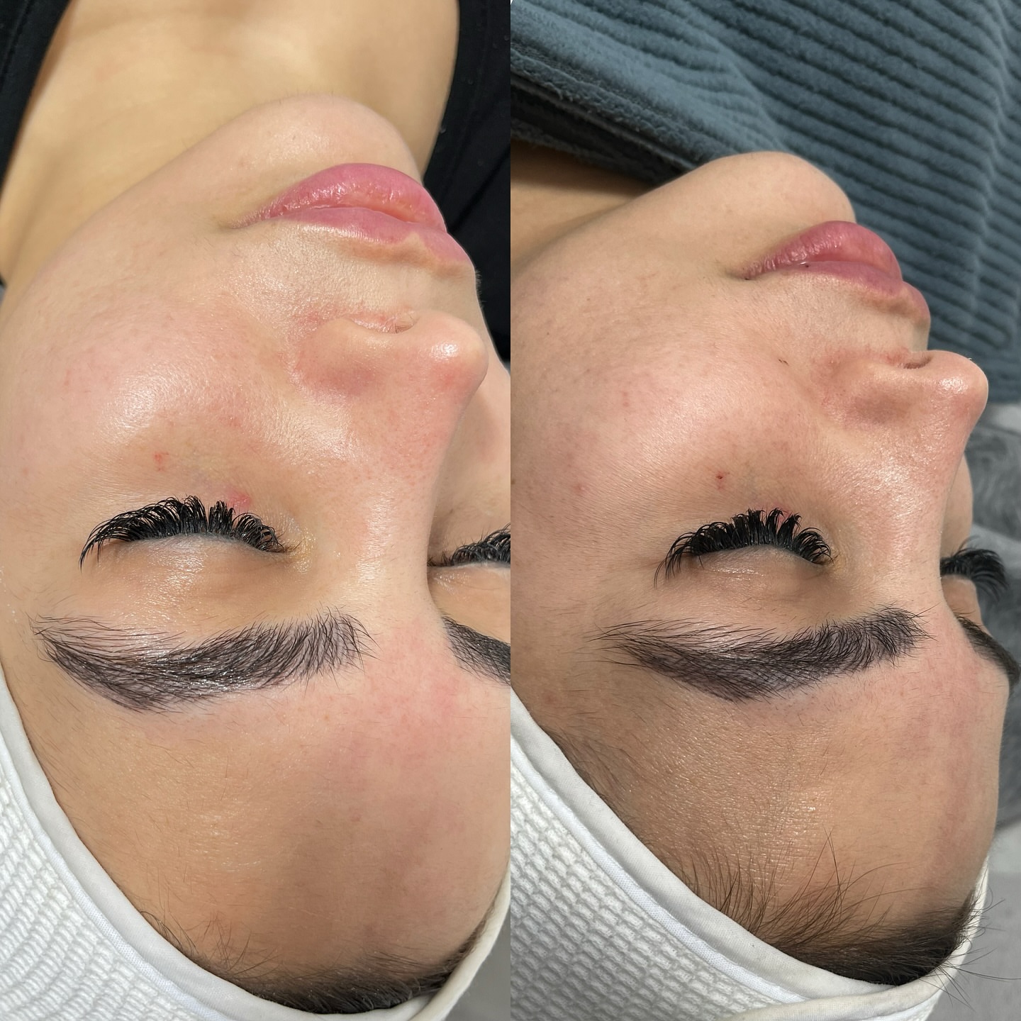 خدمات تخصصی فیشیال پوست حسینی
