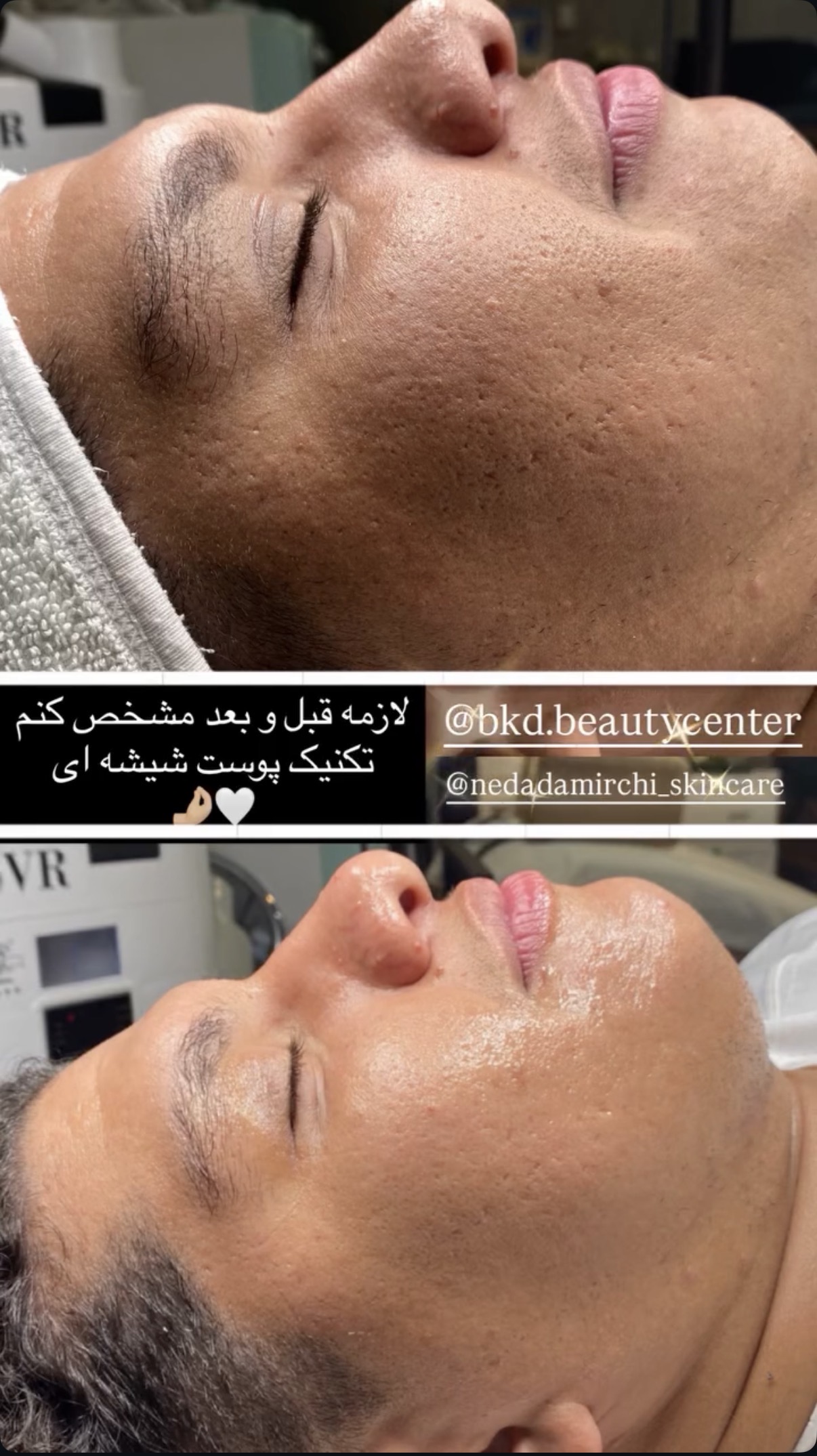 خدمات فیشال ،پاکسازی ندادمیرچی کلینیکBKD