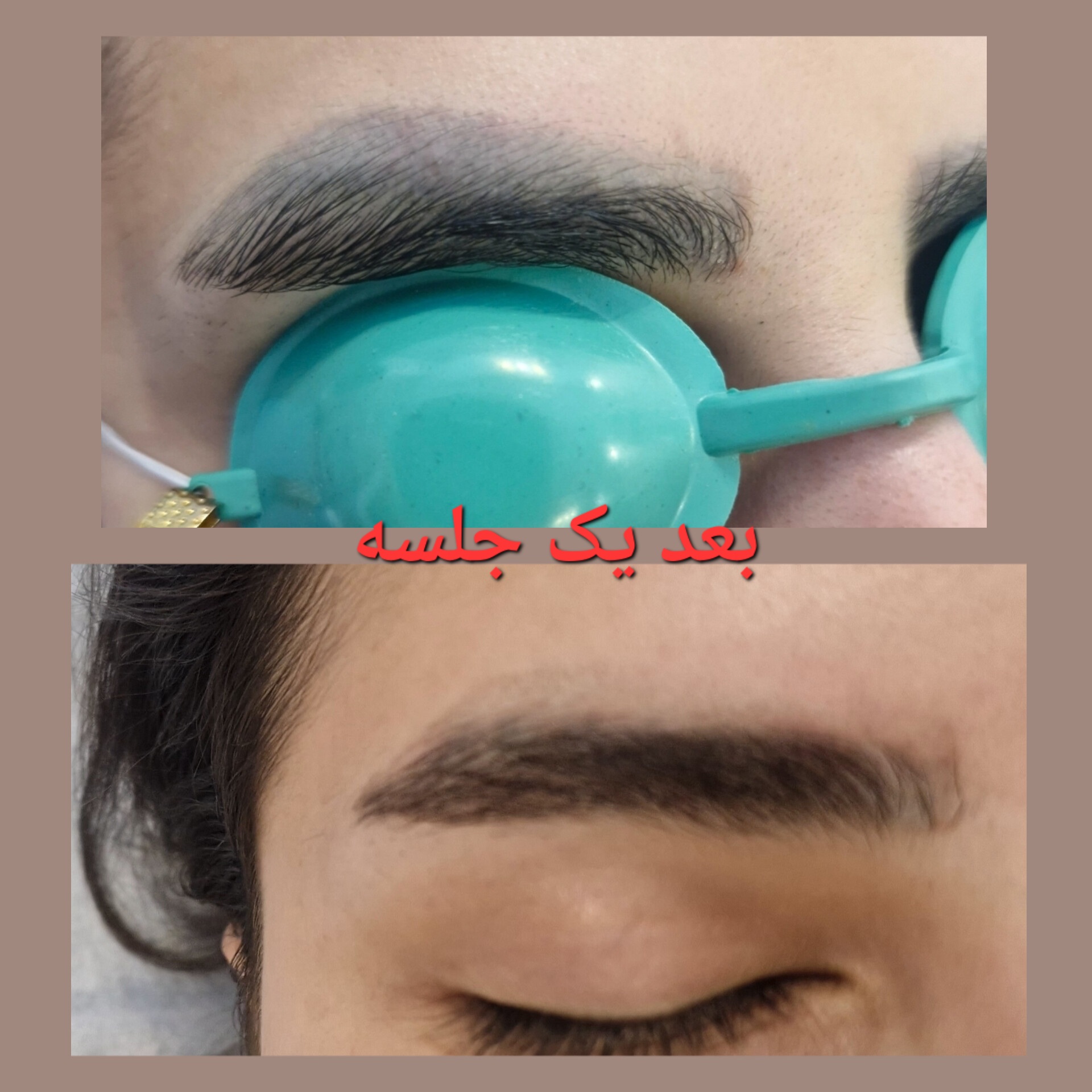 مرکز لیزر آلما
