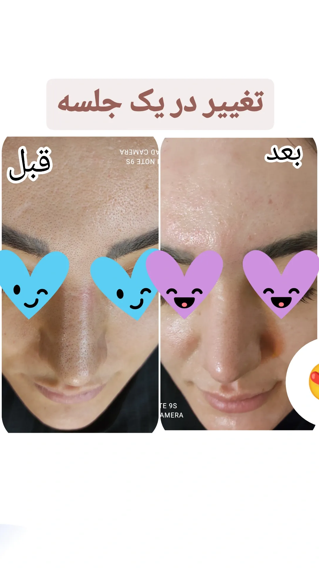خدمات تخصصی فیشیال پوست وجوانسازی پالیز