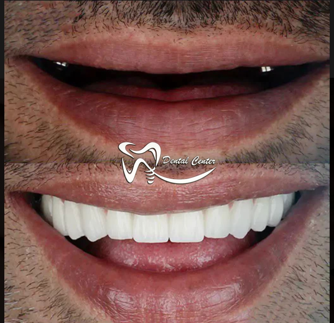 دندانپزشکی دکتر پیمبر نیا ایمپلنتولوژیست