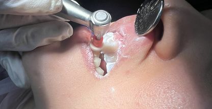 کلینیک دندانپزشکی مانا دنت ایمپلنت