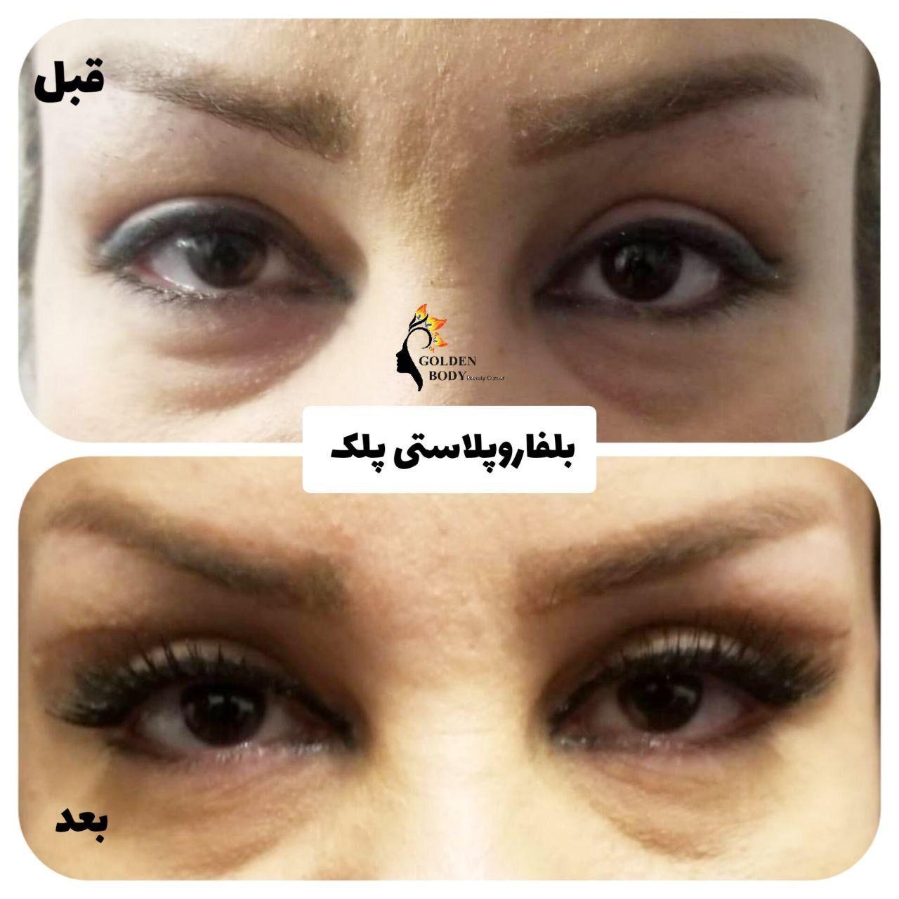 کلینیک پوست مو زیبایی و لیرزگلدن بادي