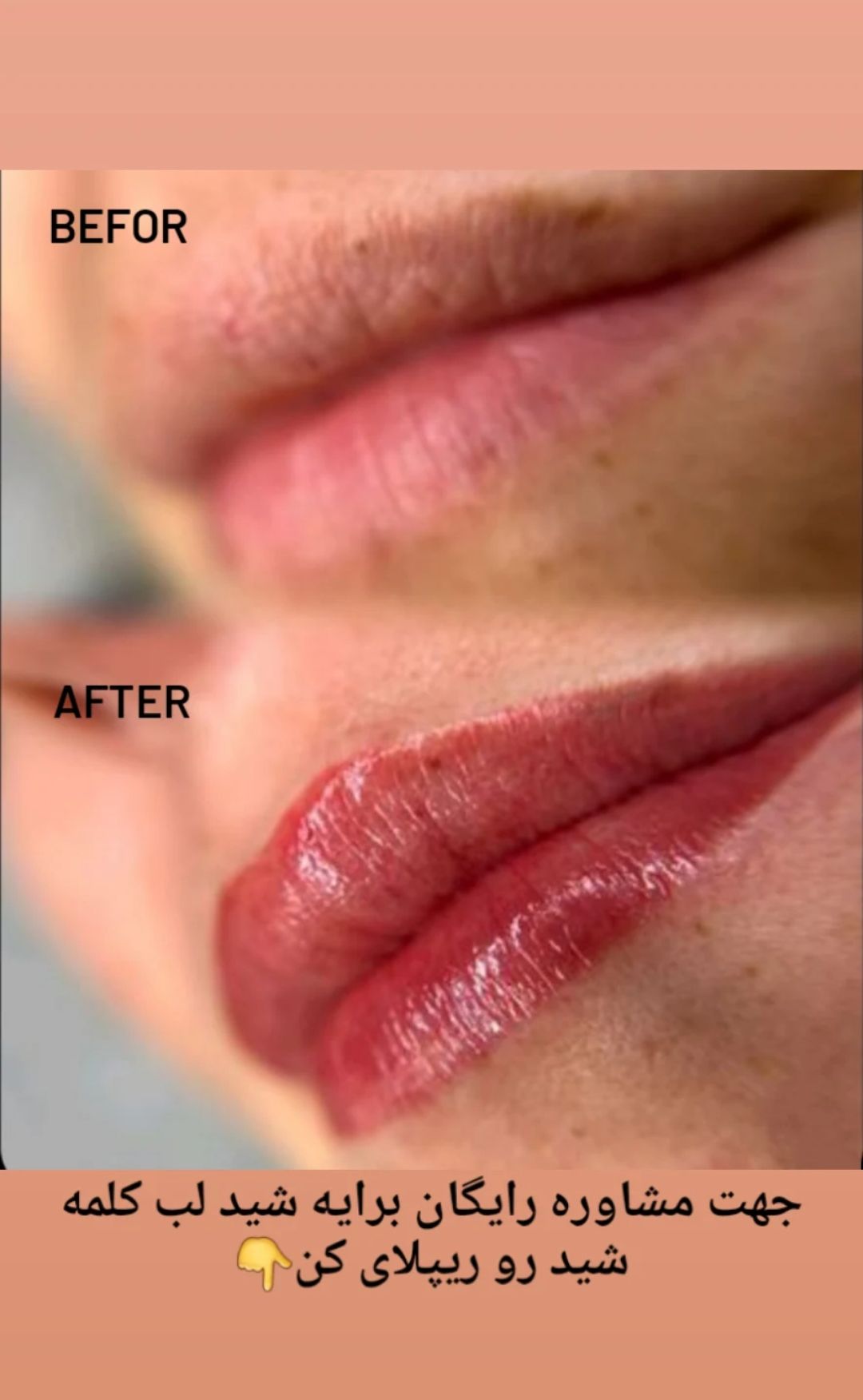 خدمات تخصصی تتو پرشین