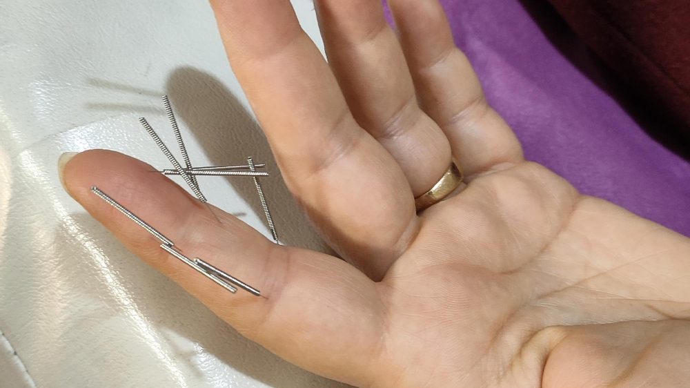 طب سوزنی و سوجوکتراپی