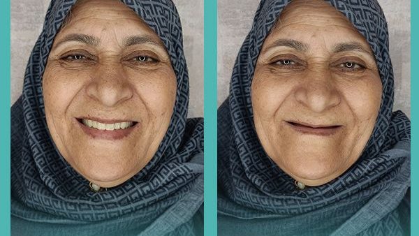 لابراتوار دندانسازی روشَنا