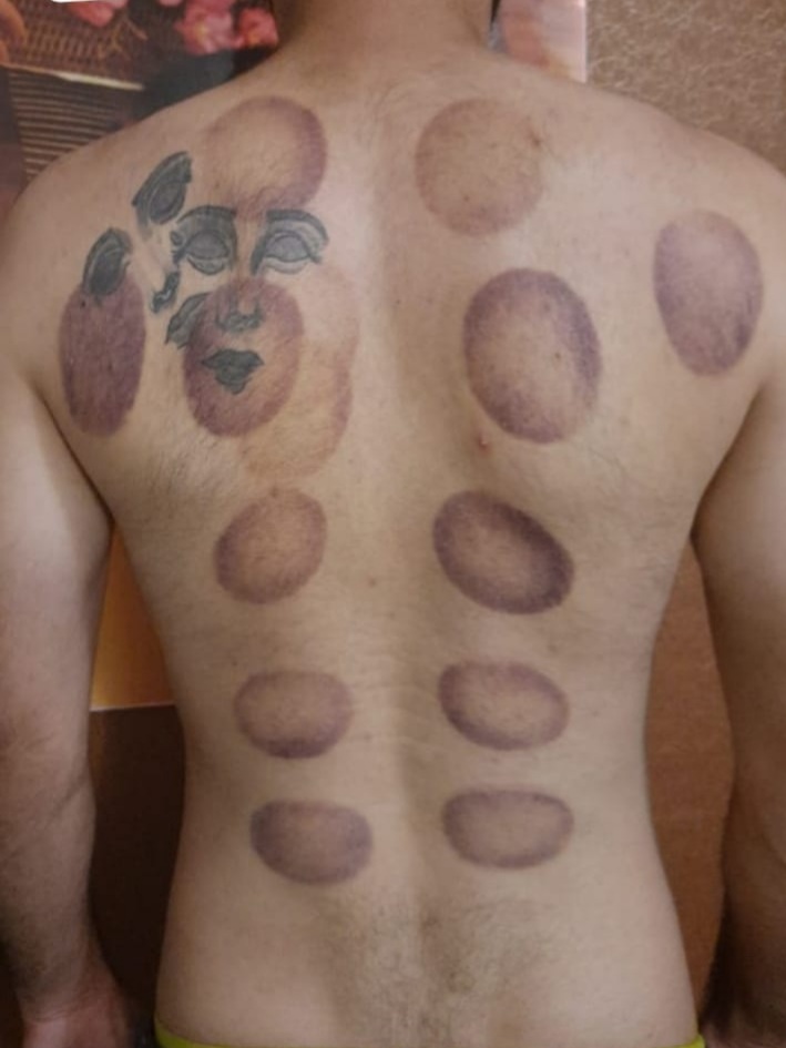 اسپرت ماساژ