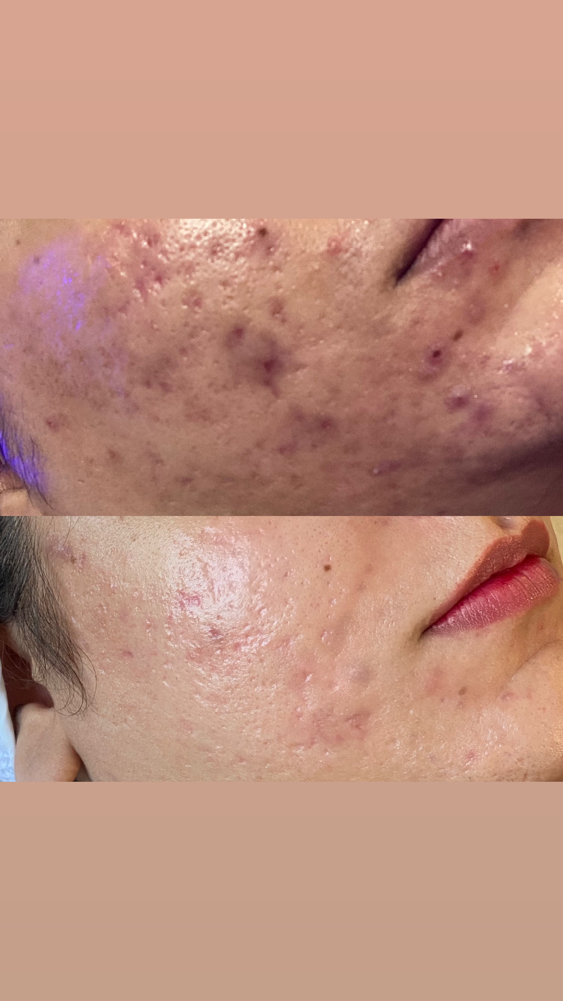 کلینیک زیبایی، فیشال امینی