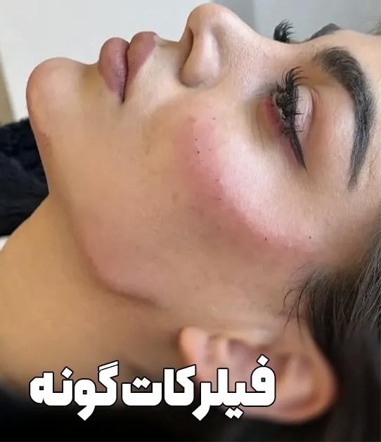 کلینیک زیبایی، پوست و مو نچرال بیوتی