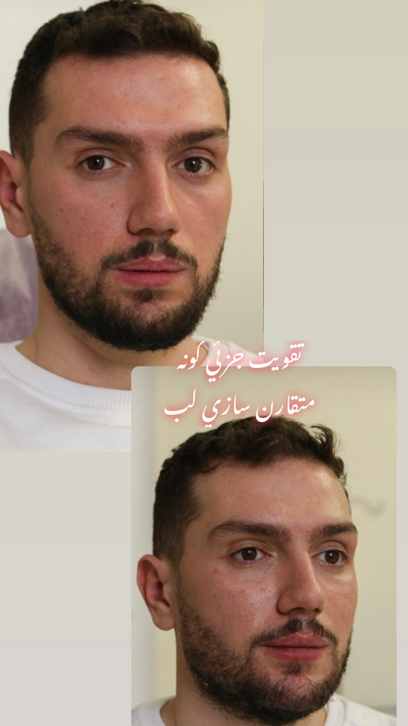 کلینیک زیبایی پوست و لیزر آلن