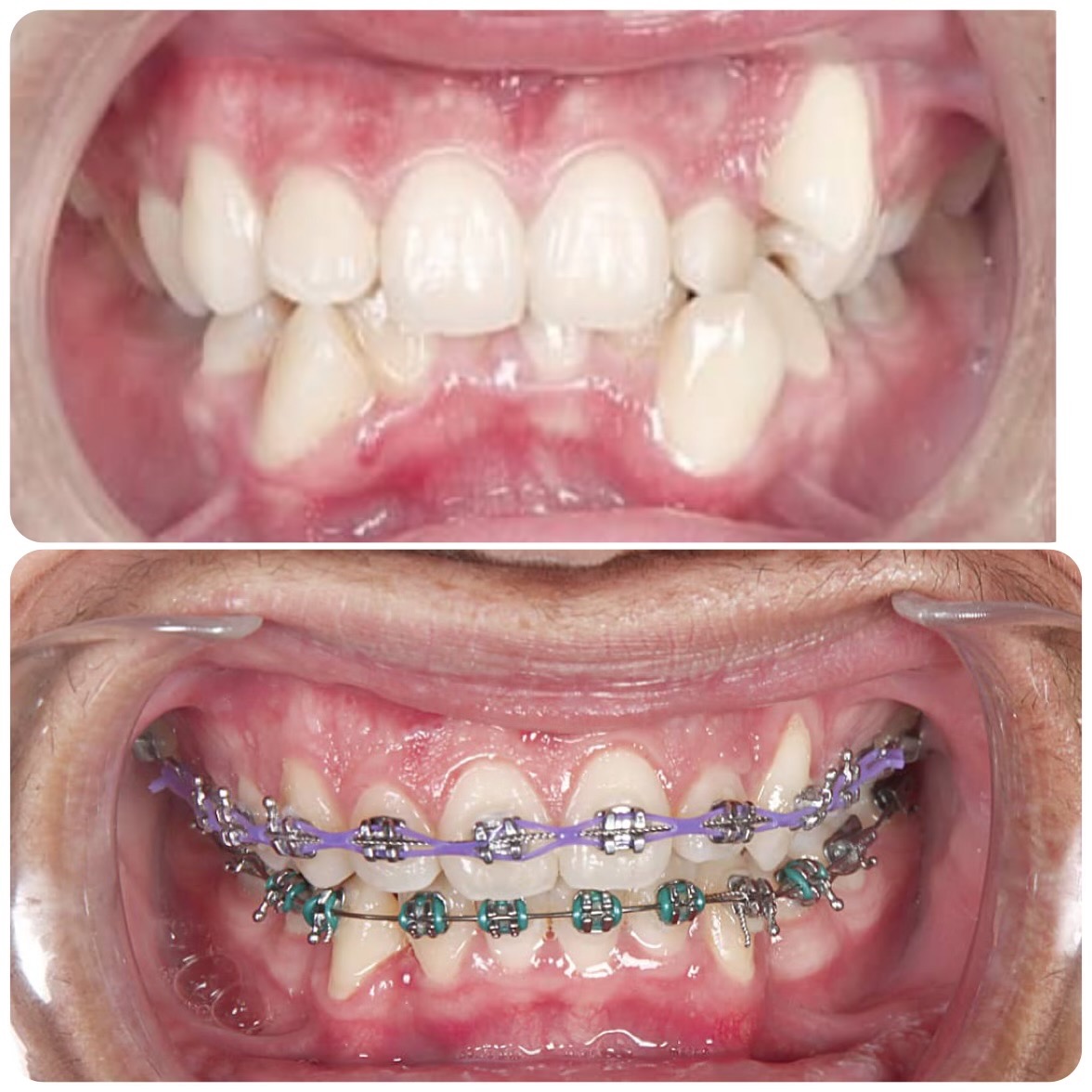 دندانپزشکی کودکان  دکتر شقایق جمالی