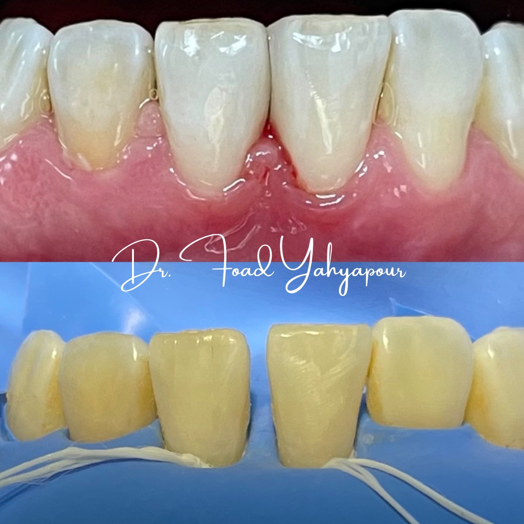 مطب دندانپزشکی دکتر یحیی پور-بیمه داریم
