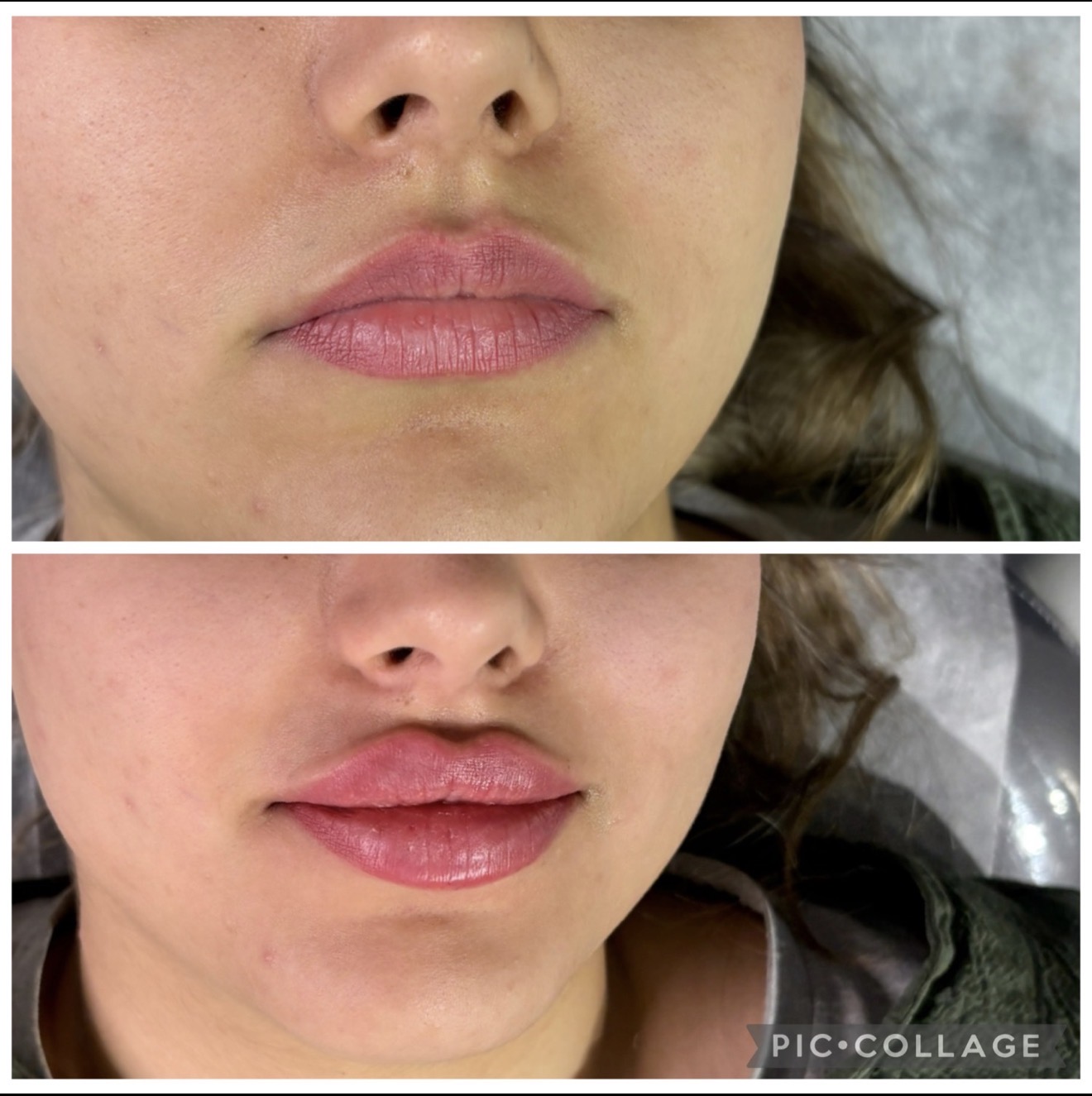 مطب زیبایی دکتر نلسا