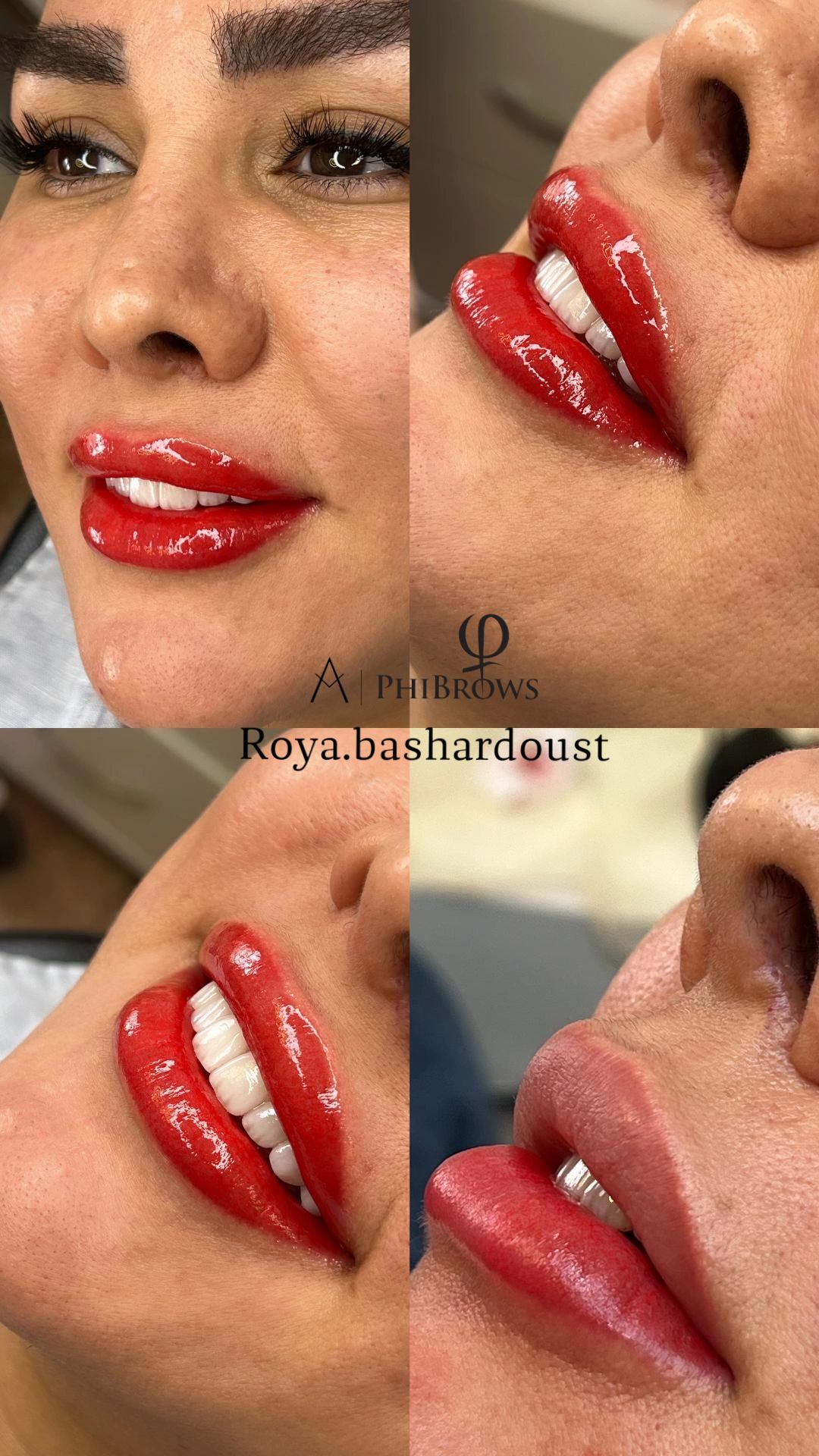 فیبروز ابرو شیدینگ لب بشردوست