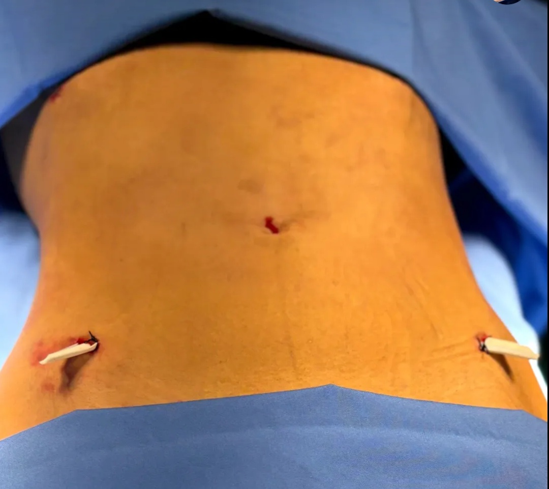 جراحی زیبایی آپادانا