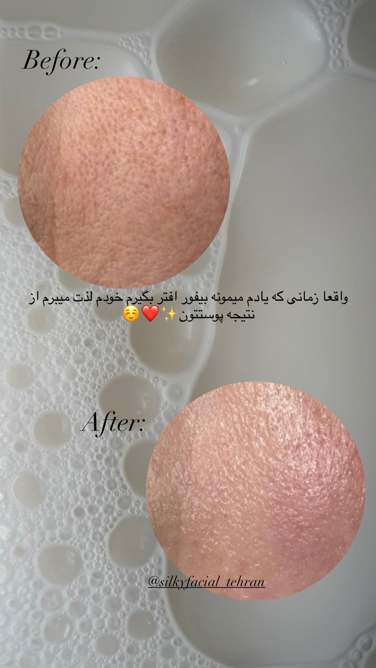مرکز پاکسازی و پلاژن تراپی سیلکی فیشال