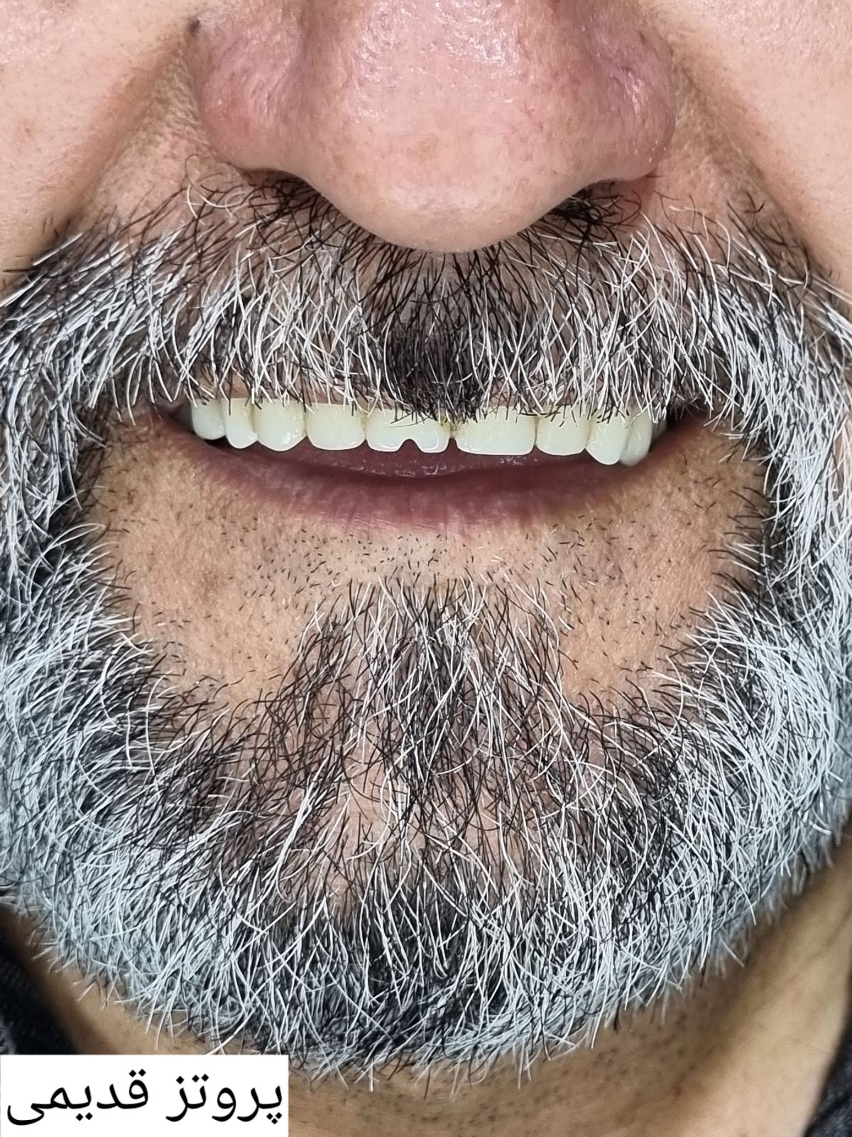 دندانسازی