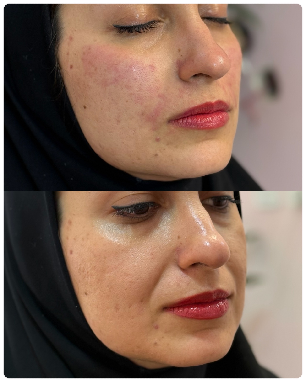 کلینیک زیبایی چشمه