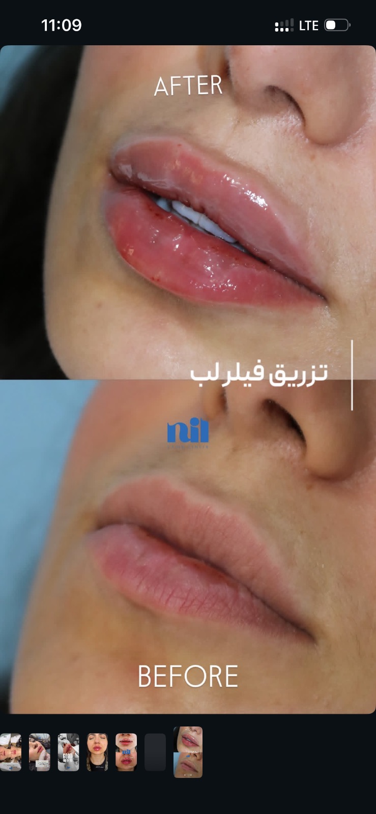 کلینیک زیبایی و لیزر نیل