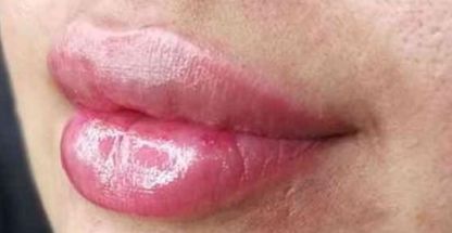 کلینیک زیبایی آیلین