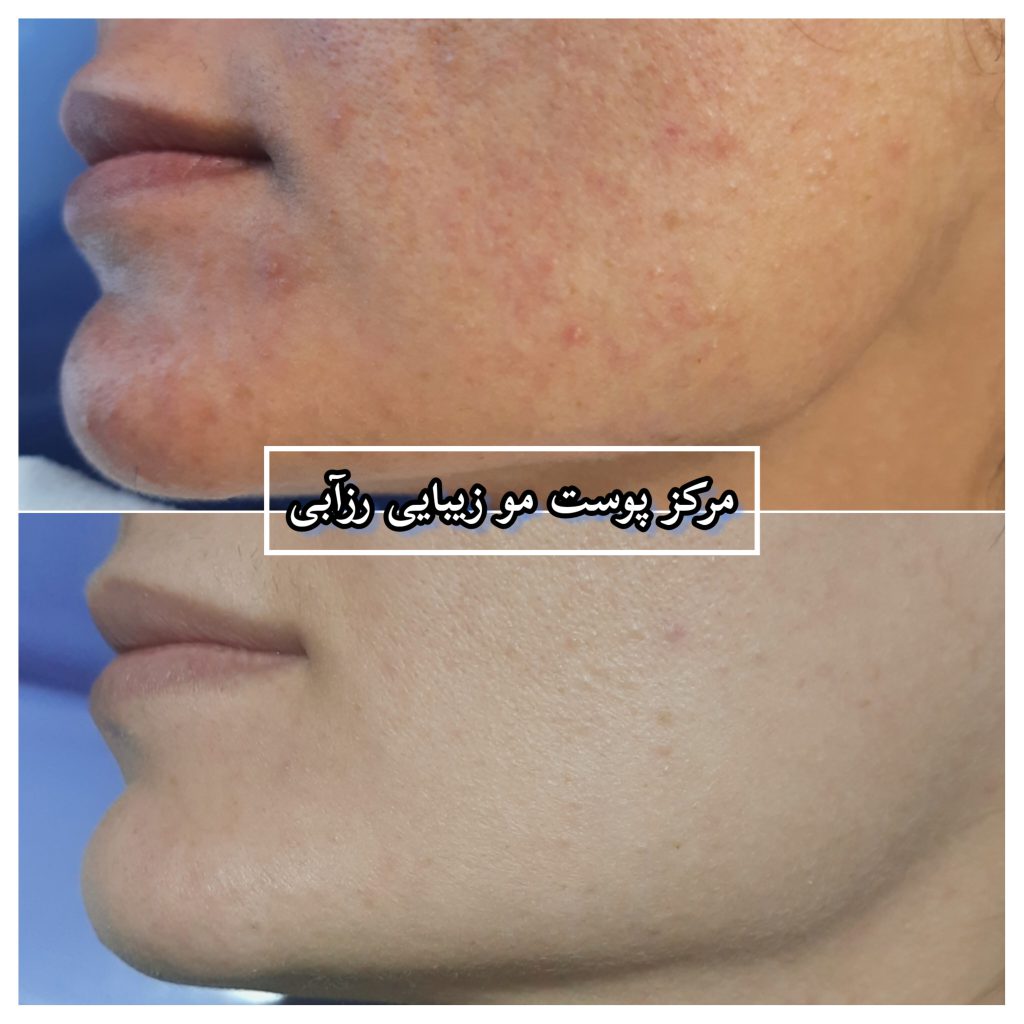 مرکز مژه و فیشیال متین