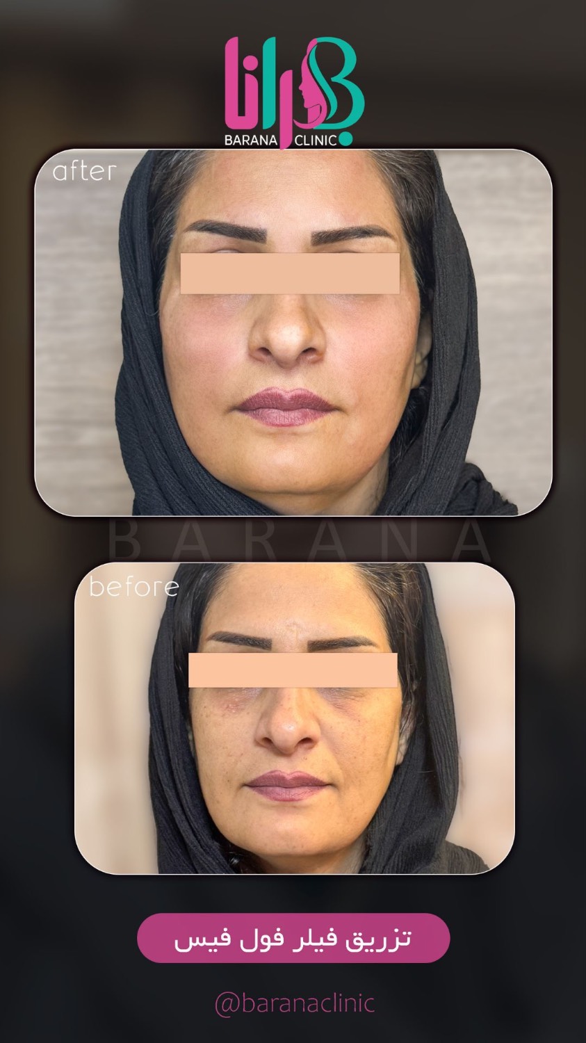 کلینیک پوست،مو، زیبایی و لیزر بارانا