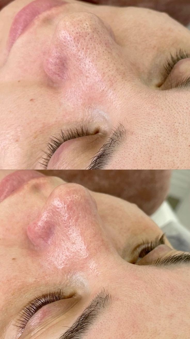 خدمات تخصصی پاکسازی پوست فروغ یزدانی