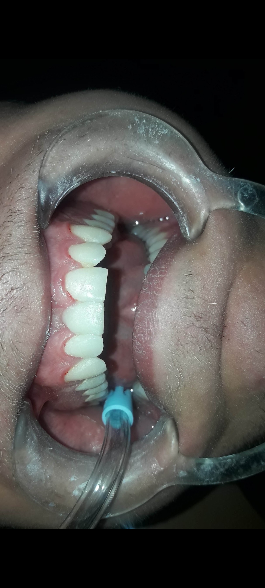 دندان پزشکی علی نفریه