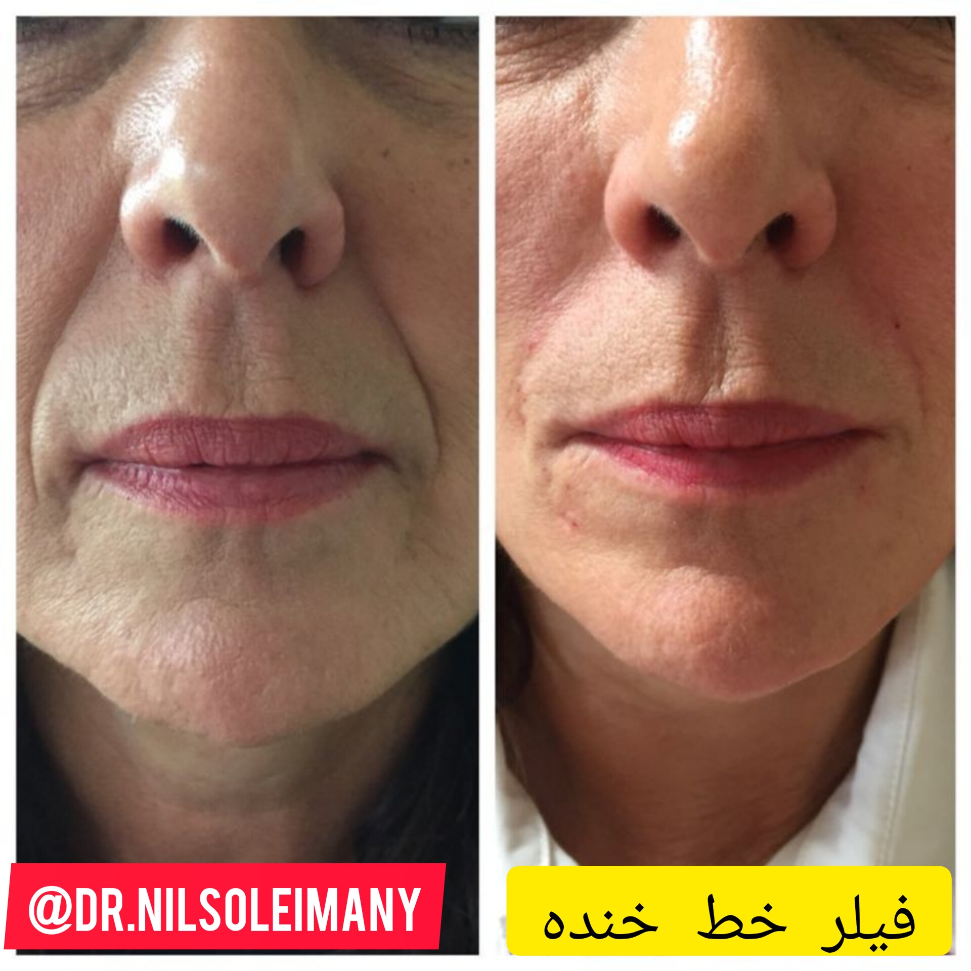 دکتر نیلوفر سلیمانی پوست و مو و زیبایی