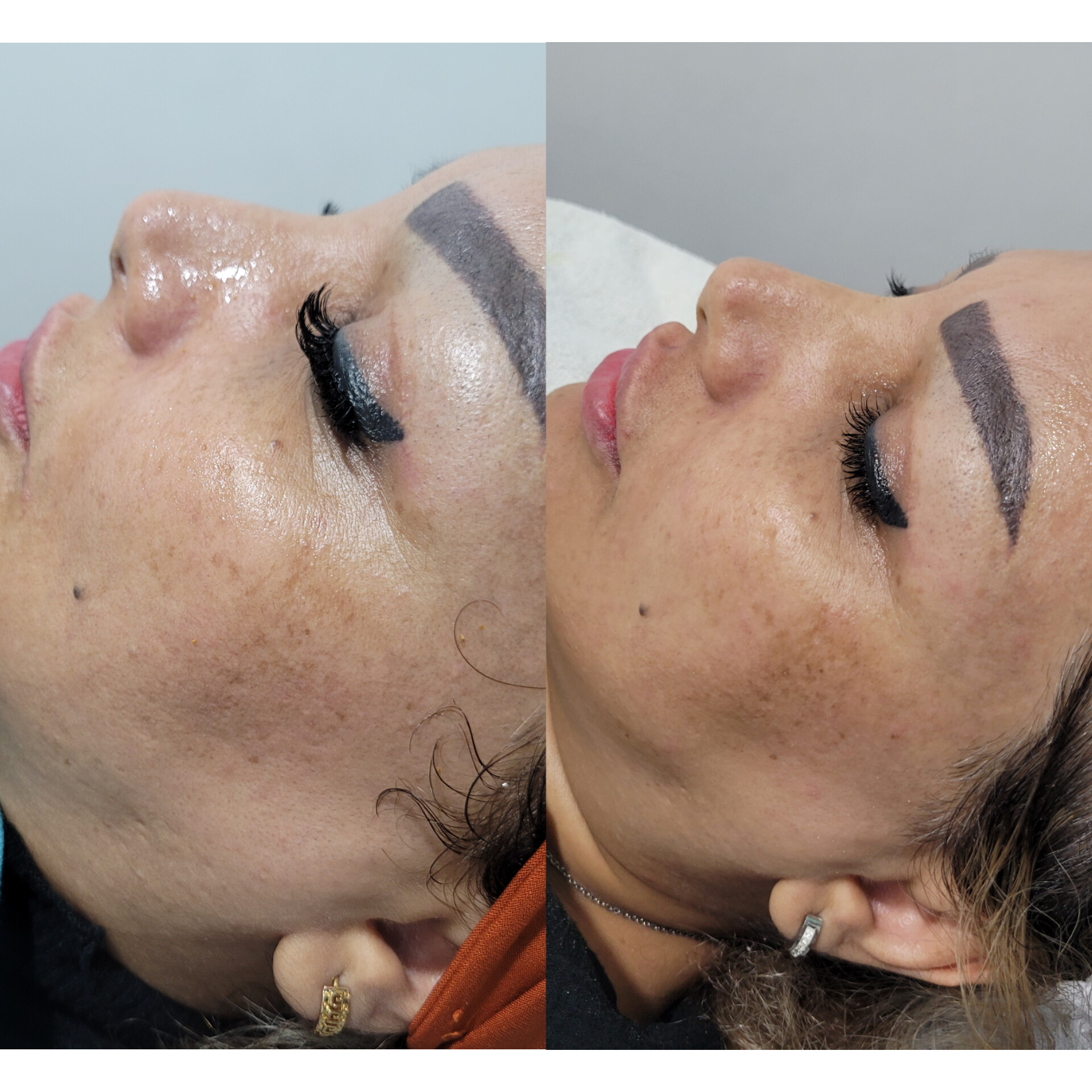 مرکز خدمات فیشیال الی فردیس